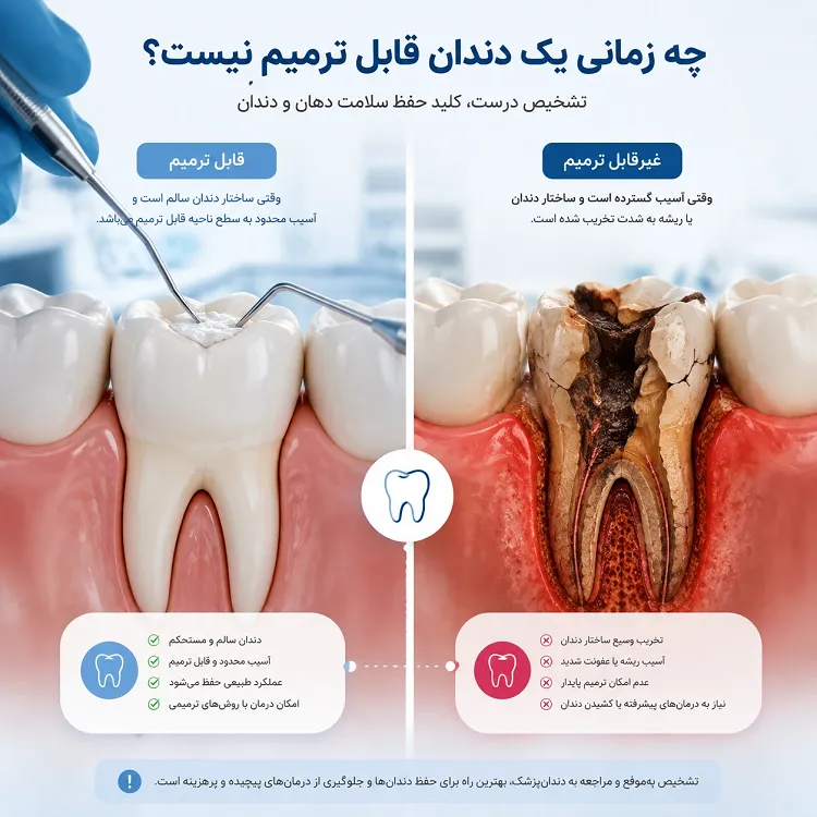 علائم دندان غیر قابل ترمیم که باید بدانید