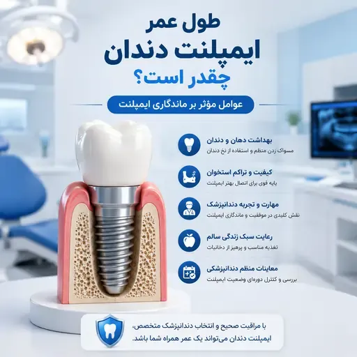 طول عمر ایمپلنت دندان چقدر است؟