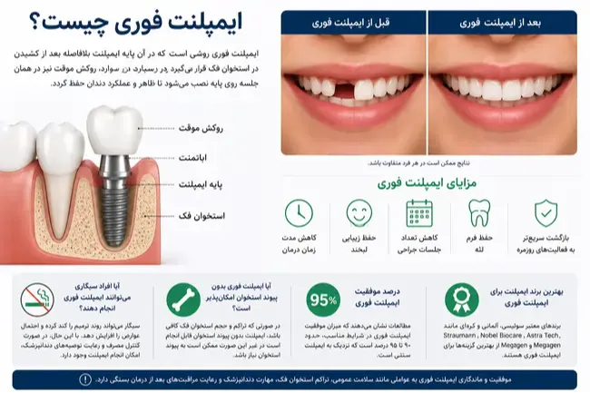 🦷 آیا می‌شود دندان از دست‌ رفته را در یک روز جایگزین کرد؟