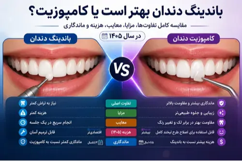 باندینگ یا کامپوزیت؟ قبل از تصمیم‌گیری این ۵ نکته را بدانید