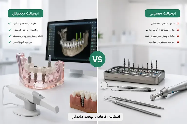 تفاوت ایمپلنت دیجیتال و معمولی چیست؟ کدام روش بهتر است؟
