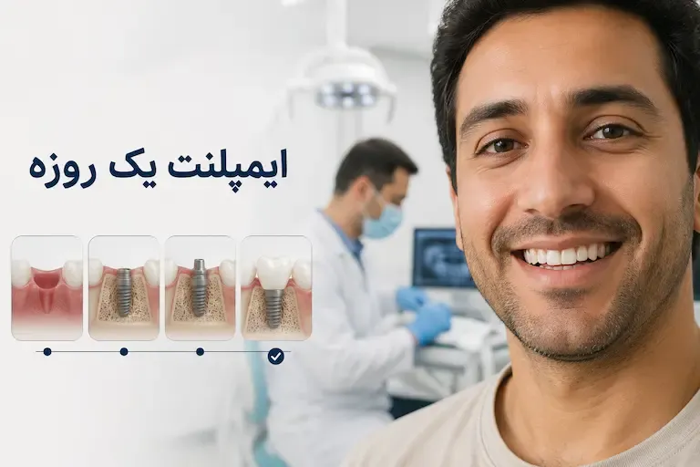 ایمپلنت یک روزه چیست؟ آیا واقعاً می‌توان در یک روز دندان کاشت؟