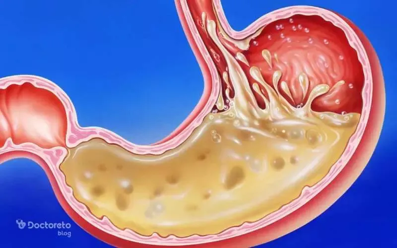 بررسی تطبیقی تلخاب در طب سنتی و مدرن