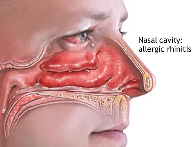 نزله در «هدایة المتعلمین» و تحلیل علمی نوین